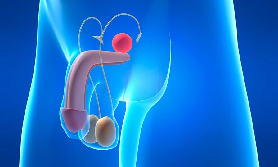 Edema de próstata con prostatite