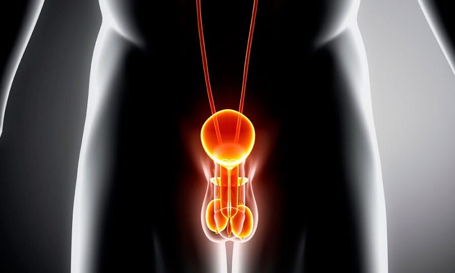 Geniturina inflamada para a prostatite
